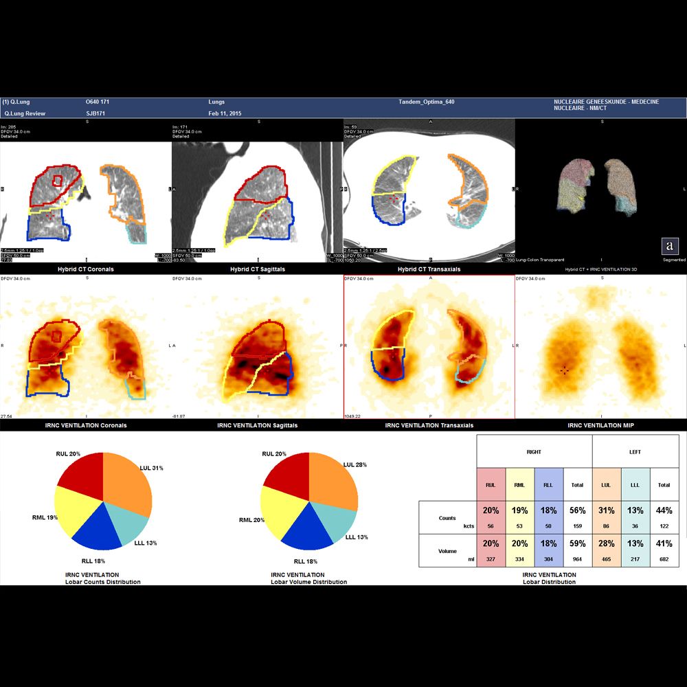 Оборудование ядерной медицины GE Healthcare NM/CT 850 — изображение 5