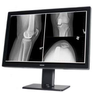 Медицинский монитор Barco Coronis Fusion 4MP MDCC-4430