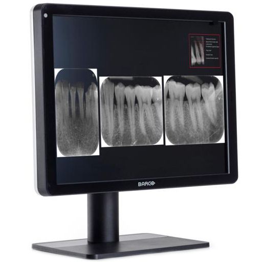 Медицинский монитор Barco Nio Color 3MP Dental — изображение 2