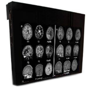 Медицинский монитор Double Black Imaging 24 MRSafe Display"