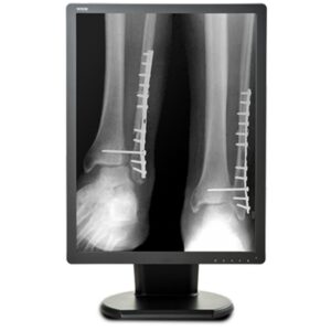 Медицинский монитор Double Black Imaging 2MP Monochrome