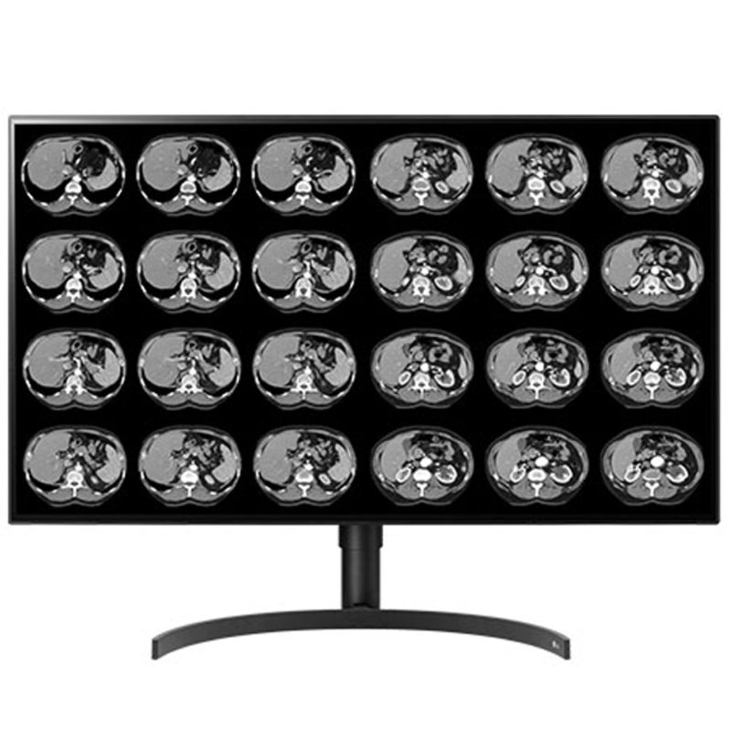 Медицинский монитор Double Black Imaging 32 Color 8MP Large Format Display"