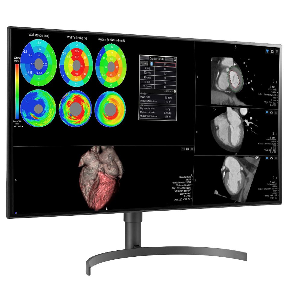 Медицинский монитор Double Black Imaging 32 Color 8MP Large Format Display" — изображение 2