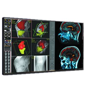 Медицинский монитор Double Black Imaging 42 Professional LCD"