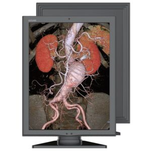 Медицинский монитор Jusha C270G