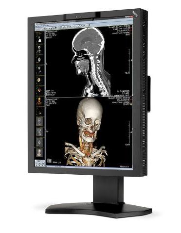 Медицинский монитор NEC MD211C3 — изображение 2
