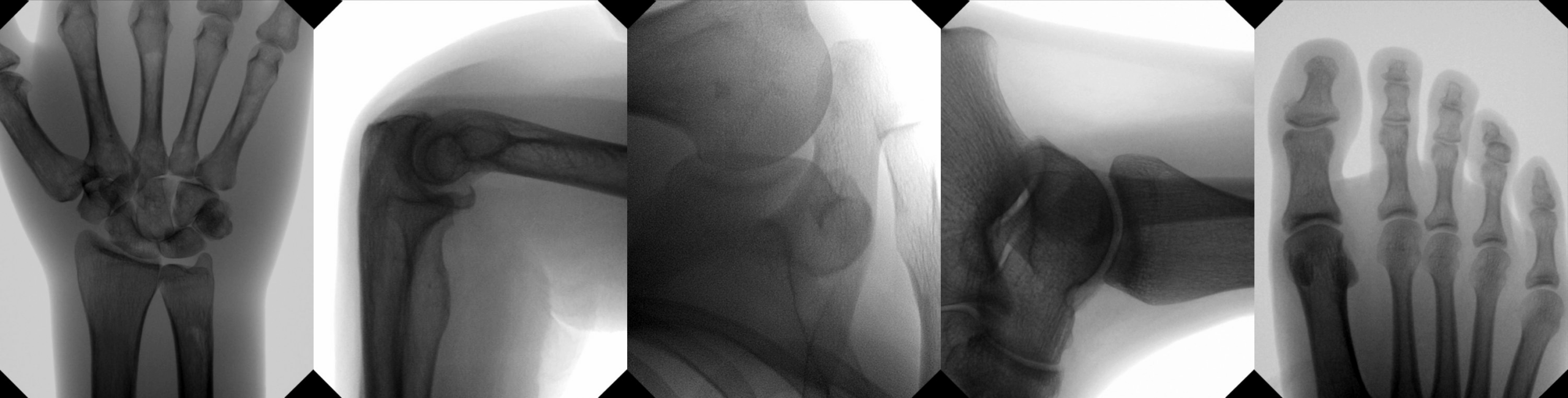 С-дуга Orthoscan Mobile DI — изображение 4